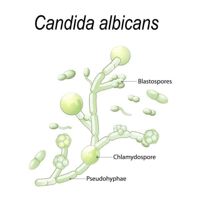 Candida Yeast Overgrowth–Causes, Symptoms, and Solutions