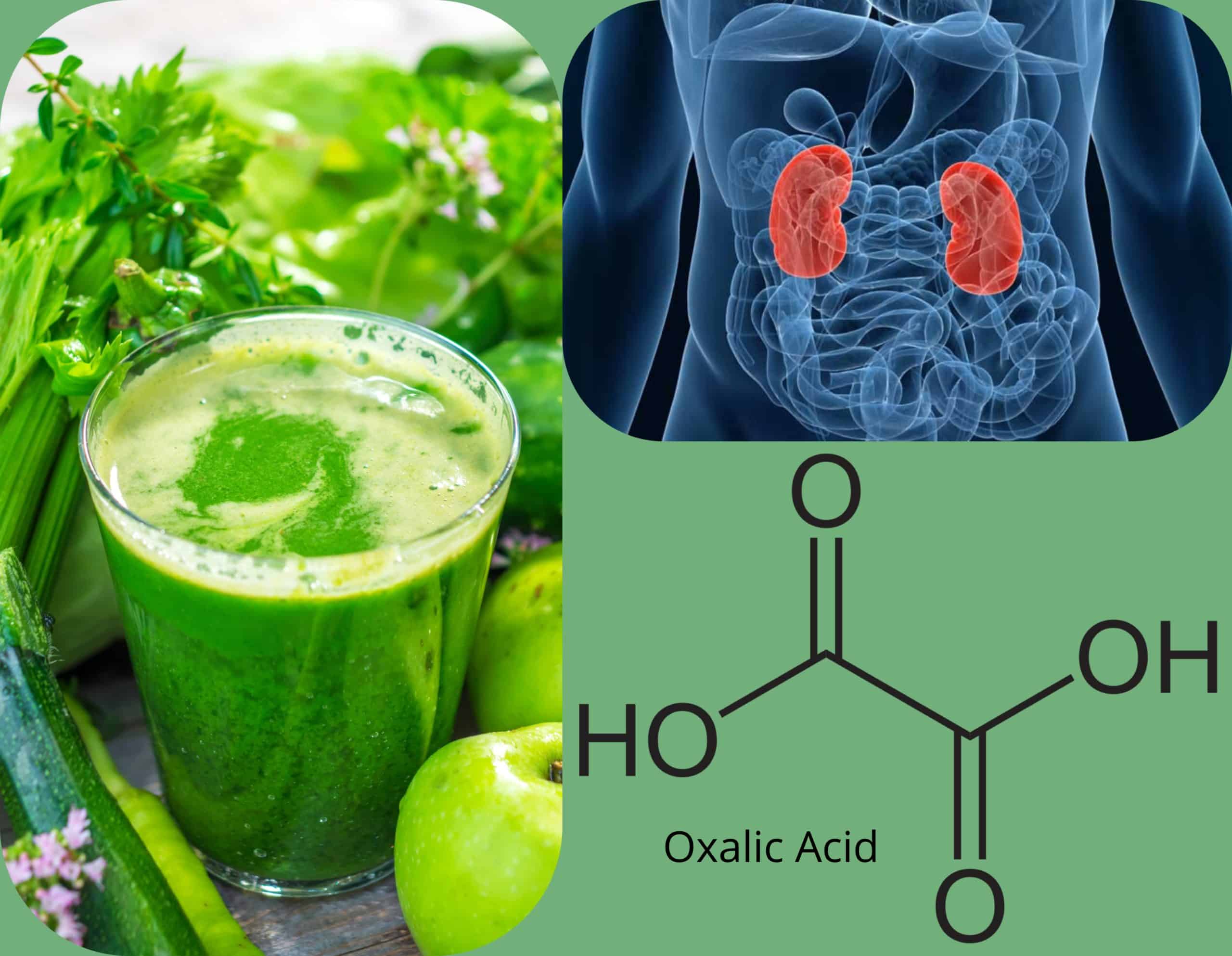Are Oxalates Messing With Your Health?