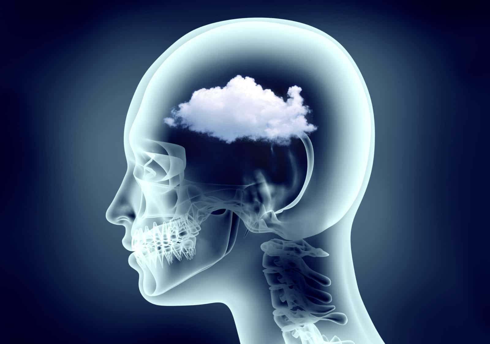 Sinusitis Wellness | What Exactly is “Brain Fog”?